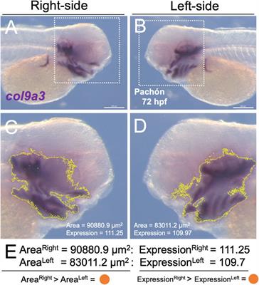 An analysis of lateralized neural crest marker expression across development in the Mexican tetra, Astyanax mexicanus